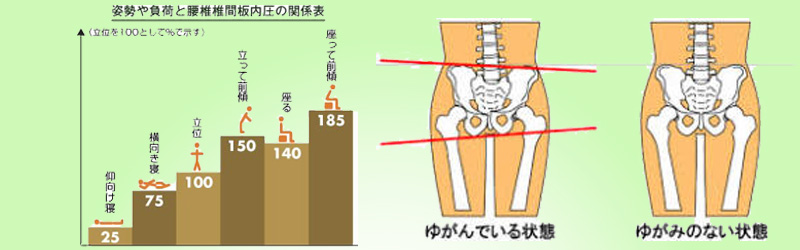 座っていても痛い!!「骨盤のゆがみ」