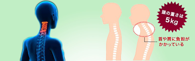 肩こり・首痛はどうして起こる？